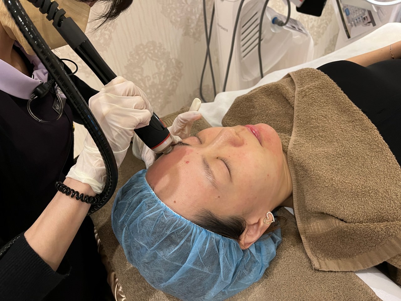 【油痘粉刺肌必看】佳思優整形醫美診所『黑鑽水飛梭』初體驗，粉刺大掃除，肌膚亮出新高度～