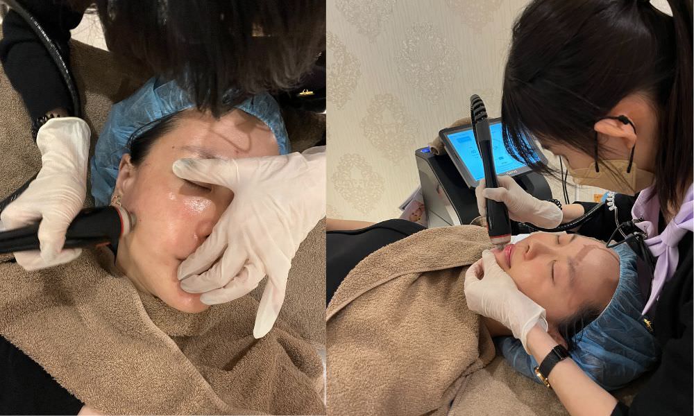 【油痘粉刺肌必看】佳思優整形醫美診所『黑鑽水飛梭』初體驗，粉刺大掃除，肌膚亮出新高度～