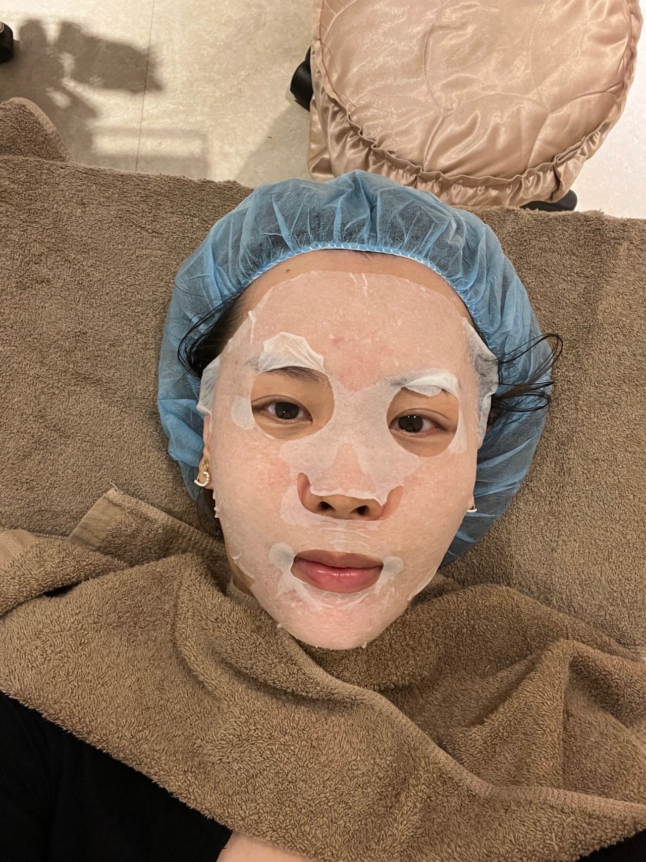 【油痘粉刺肌必看】佳思優整形醫美診所『黑鑽水飛梭』初體驗，粉刺大掃除，肌膚亮出新高度～