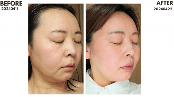 ZIIP HALO 美膚儀實測使用心得～居家美容、出國旅遊必備奈米微電流美膚儀！