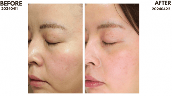 ZIIP HALO 美膚儀實測使用心得～居家美容、出國旅遊必備奈米微電流美膚儀！