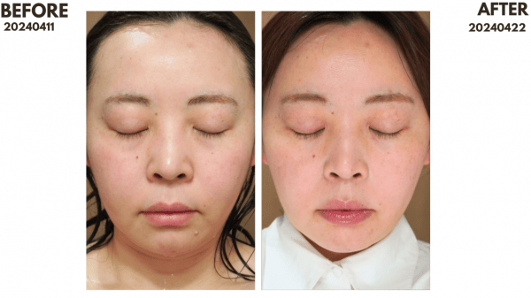 ZIIP HALO 美膚儀實測使用心得～居家美容、出國旅遊必備奈米微電流美膚儀！