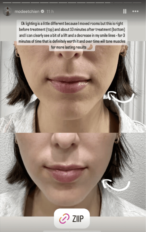 ZIIP HALO 美膚儀實測使用心得～居家美容、出國旅遊必備奈米微電流美膚儀！