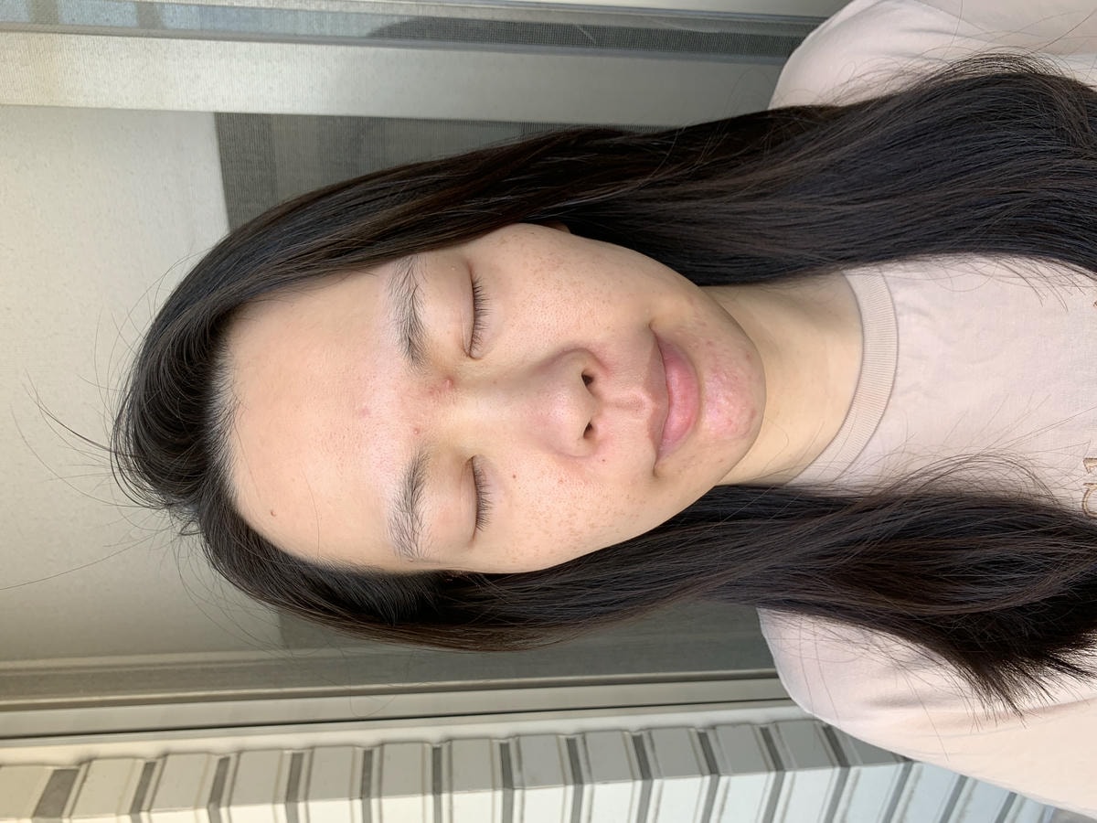 沒打水光針,卻亮回素顏巔峰!我怎麼靠「胎盤素噴霧」從酒糟肌養出發光肌?(文末優惠) - 第4張圖 沒打水光針,卻亮回素顏巔峰!我怎麼靠「胎盤素噴霧」從酒糟肌養出發光肌?(文末優惠)