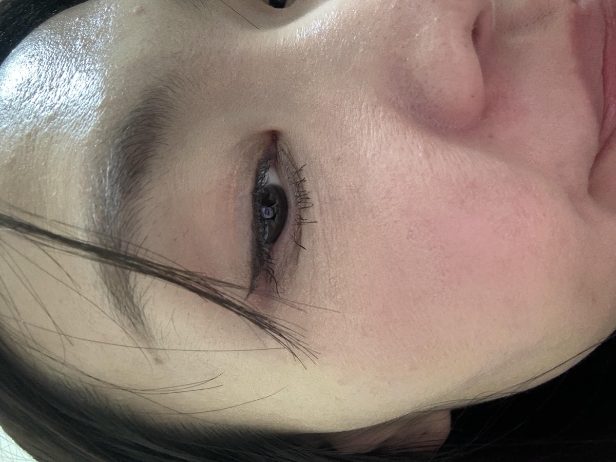 沒打水光針,卻亮回素顏巔峰!我怎麼靠「胎盤素噴霧」從酒糟肌養出發光肌?(文末優惠) - 第7張圖 沒打水光針,卻亮回素顏巔峰!我怎麼靠「胎盤素噴霧」從酒糟肌養出發光肌?(文末優惠)