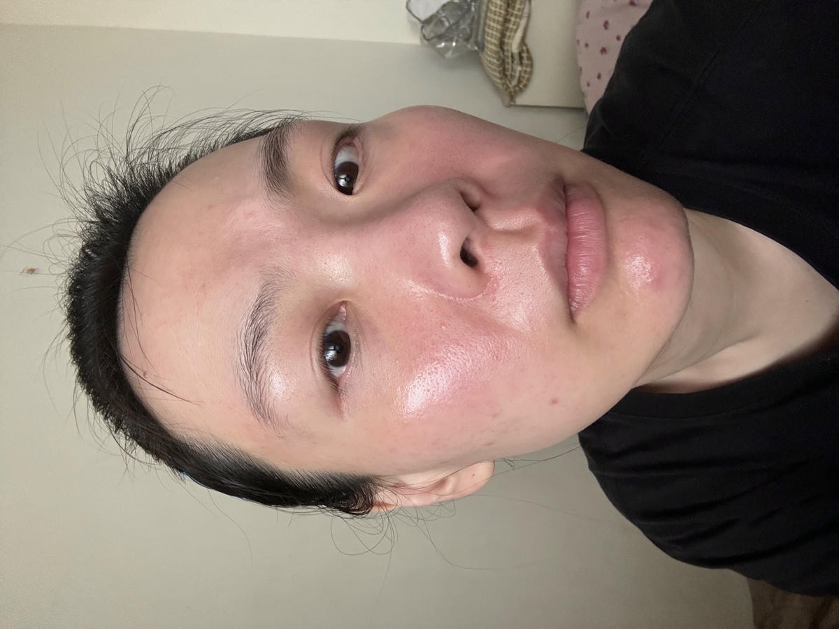 沒打水光針,卻亮回素顏巔峰!我怎麼靠「胎盤素噴霧」從酒糟肌養出發光肌?(文末優惠) - 第5張圖 沒打水光針,卻亮回素顏巔峰!我怎麼靠「胎盤素噴霧」從酒糟肌養出發光肌?(文末優惠)