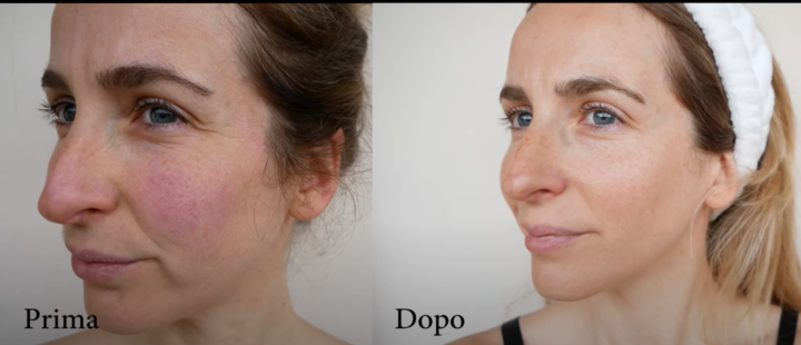 雙11限時額外8折|ZIIP HALO & CurrentBody射頻儀+Wellness系列狂省數千~萬元! - 第19張圖