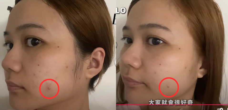 雙11限時額外8折|ZIIP HALO & CurrentBody射頻儀+Wellness系列狂省數千~萬元! - 第15張圖